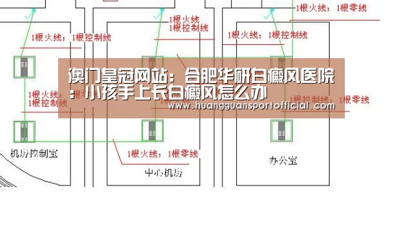 澳门皇冠网站:合肥华研白癜风医院:小孩手上长白癜风怎么办(图2) 皇冠体育官方网站